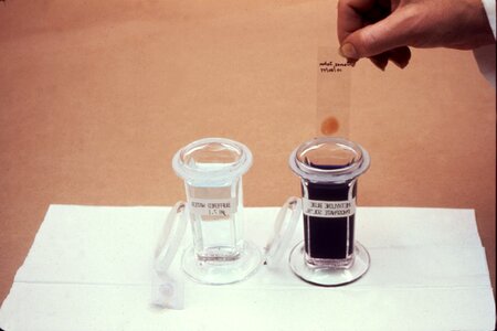 Blood film likelihood