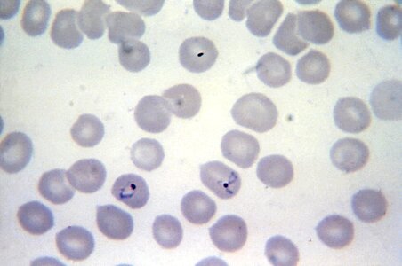 Crescent form plasmodium