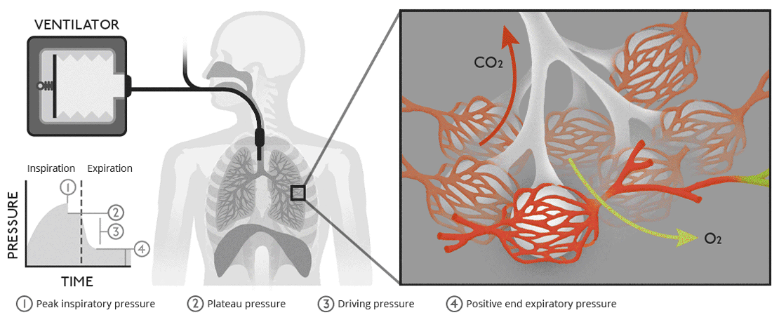 Biology of ventilation.gif