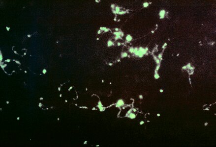 Antibody bacteria impression photo