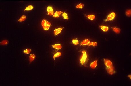 Giardia giardiasis immunofluorescence photo