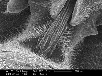 Cervix morphologic wasp