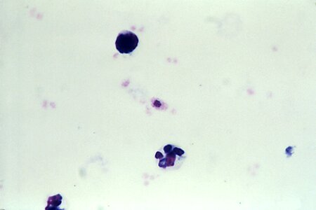 Artifact gametocyte plasmodium photo