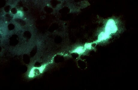 Bacteria brain chlamydia