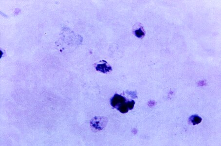 Chromatin number plasmodium photo