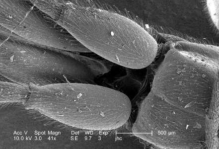 Bug debris electron micrograph