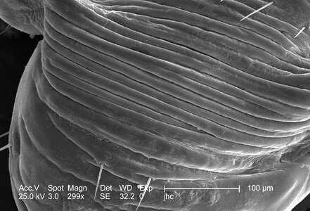 Louse male surface