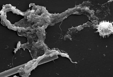 Beautiful microorganism surface photo