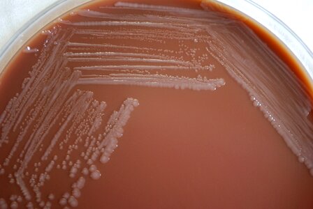 Bacteria blood agar chocolate photo