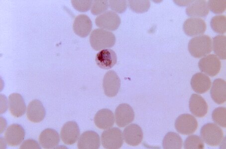 Chromatin compact cytoplasm