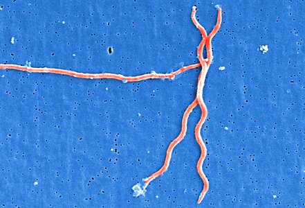 Bacteria Borrelia spirochaetaceae culture