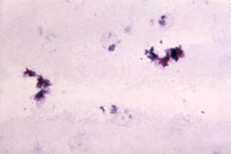 Cytoplasm dark evidence photo