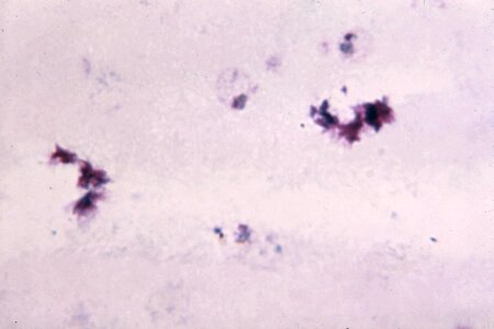 Cytoplasm dark evidence