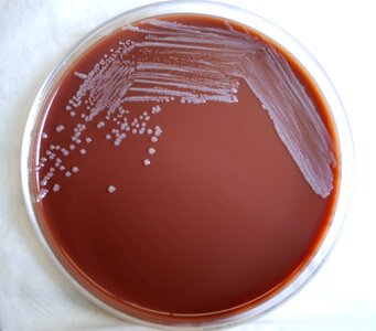 Bacteria blood agar colonial photo