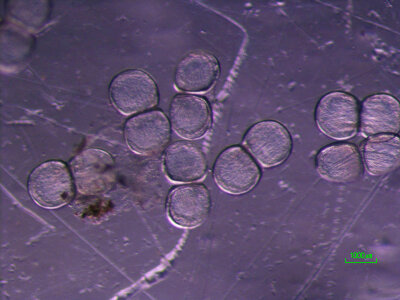 Glochidia of the golden riffleshell-1