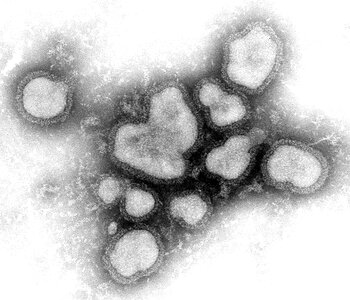 Electron influenza negative