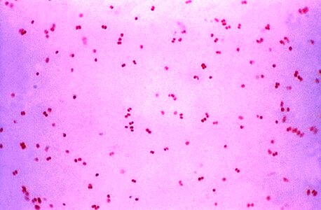 Bacteria gram negative