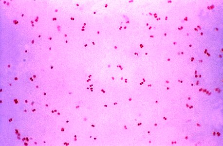 Bacteria gram negative photo