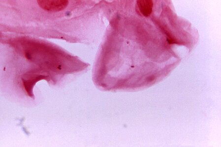 Exudate gram negative