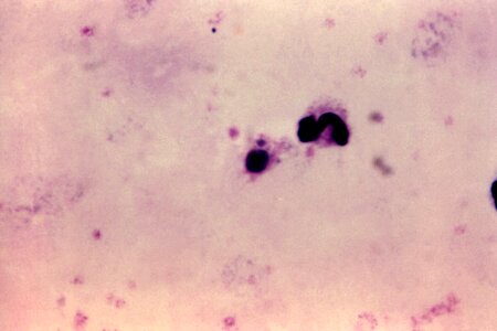Film magnification scrub