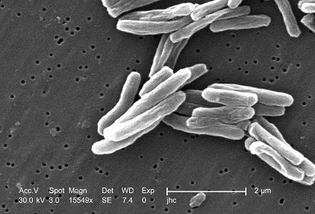 Bacteria gram positive photo