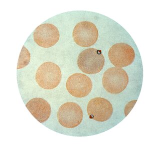 Longer malaria 