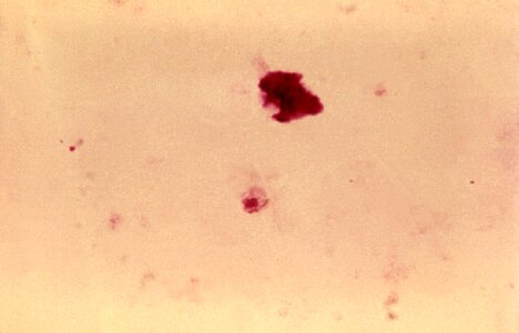 Blood Cell gametocyte plasmodium