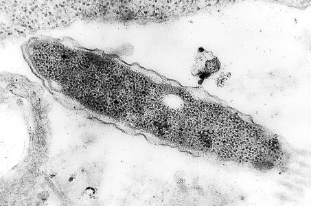 Gram negative 