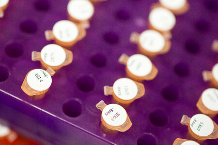 Genetic samples-1