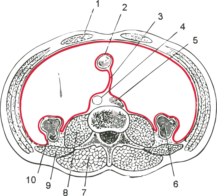 Horizontal arrangement of the peritoneum in the lower abdomen