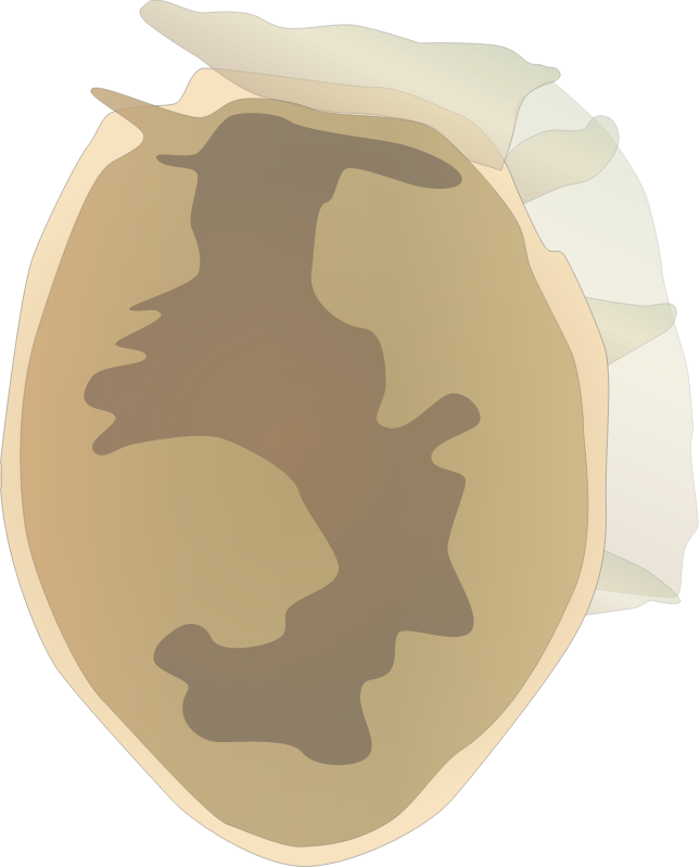 Dinoflagellate (Dinophysis Acuminata)
