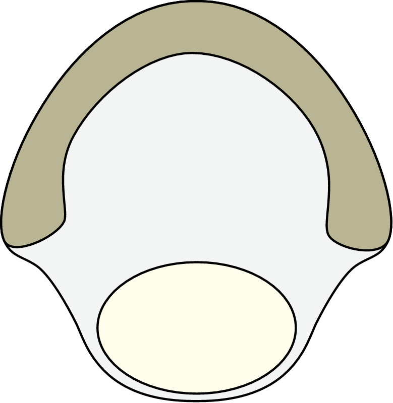 Striped Bass Egg (Morone Saxatilis)