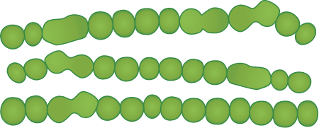 Sea Emerald Algae Microscopic View (Chaetomorpha)
