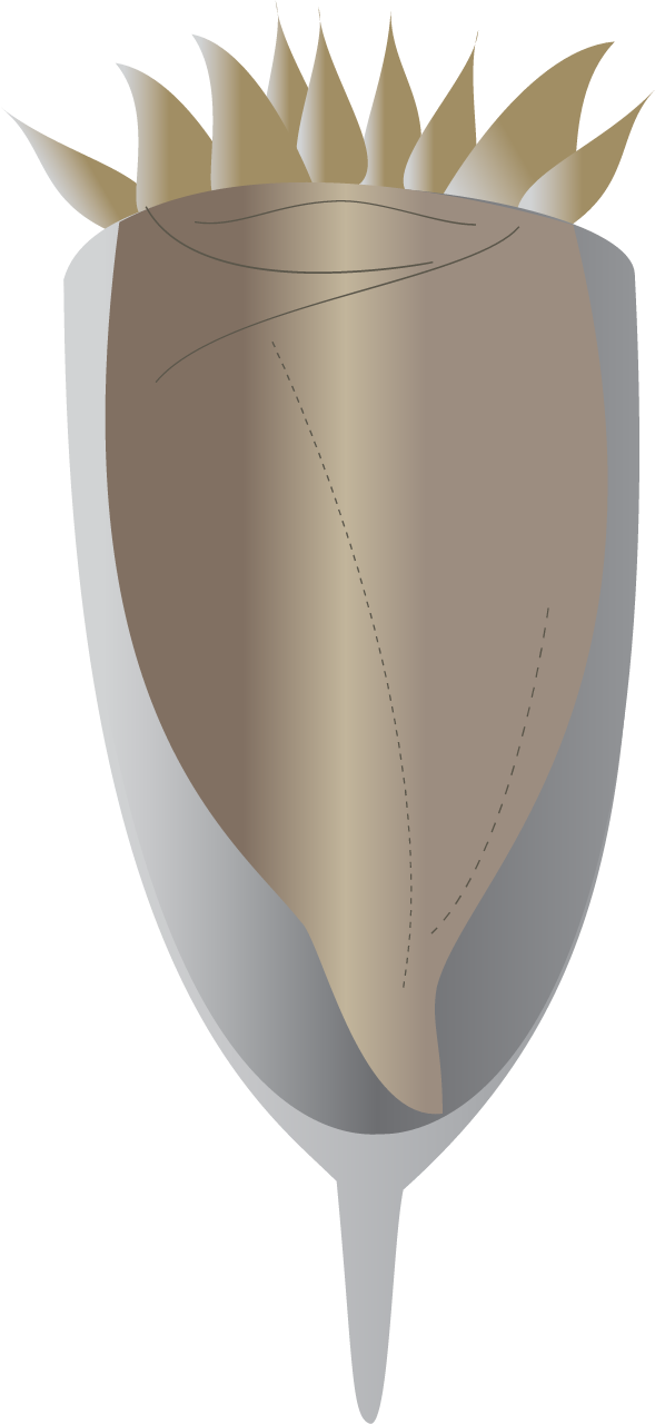 Ciliate (Tintinnid)