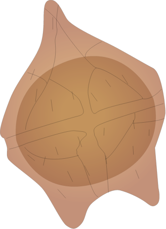 Dinoflagellate
