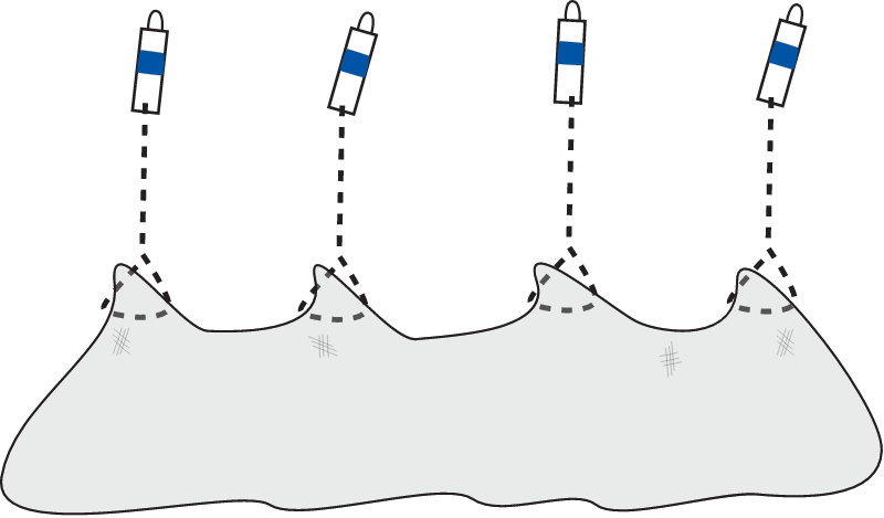 Oyster Farming