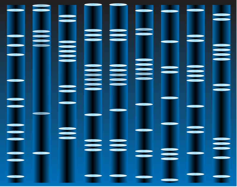 DNA Sequencing Gel