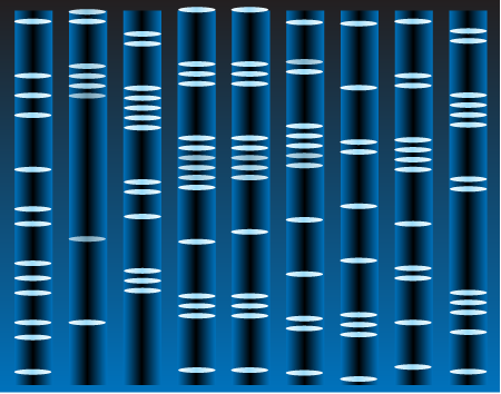DNA Sequencing Gel