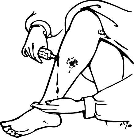 Ulcer or Running Sore – 1901 Ad