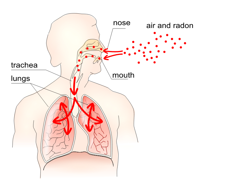 Radon in Respiratory System – Editable Diagram