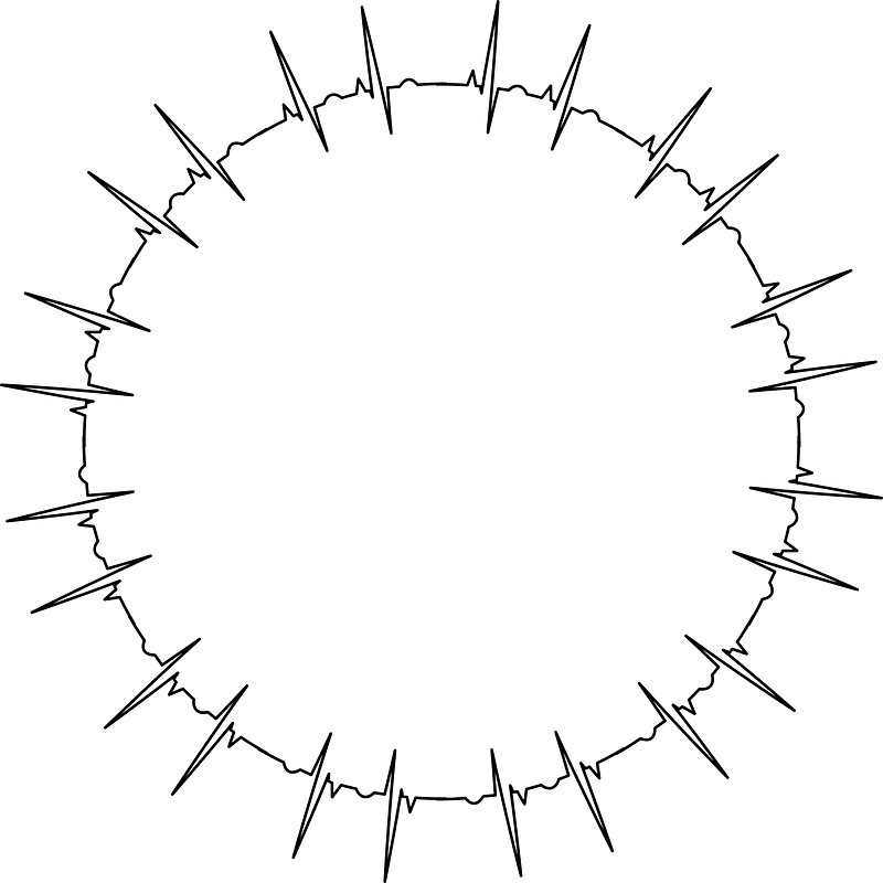 Ekg
