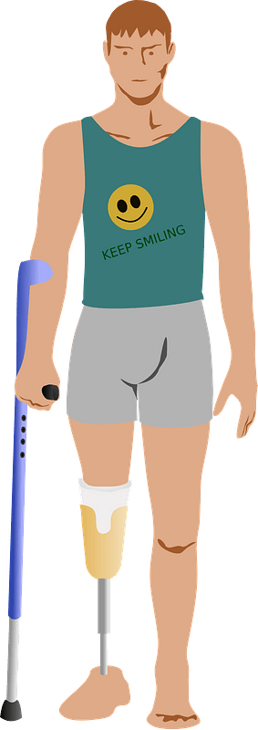 Man after amputation