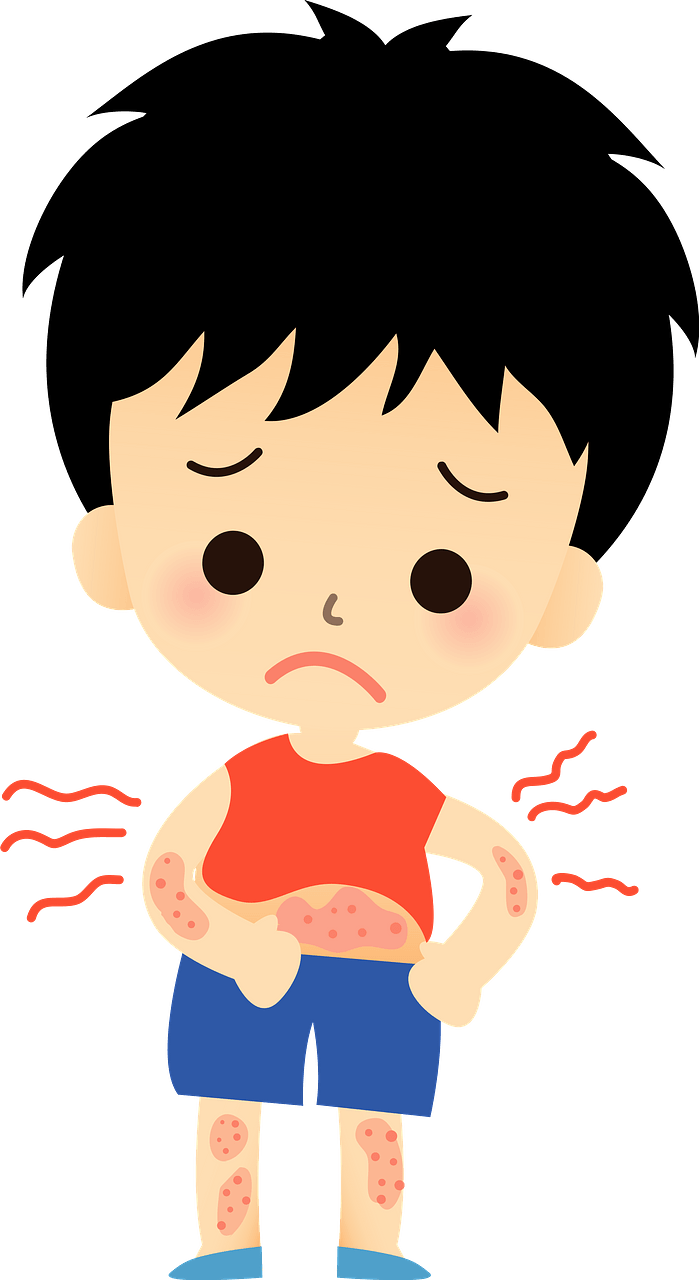 Dermatitis - Skin rash all over