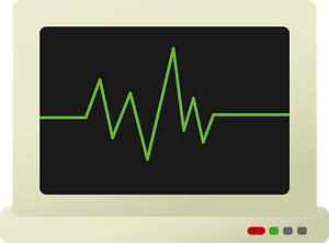 EKG Monitors