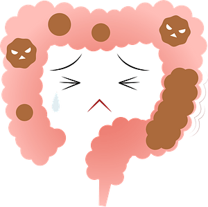 Model of Large Intestine Suffering from Constipation