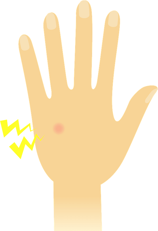 Mosquito Bite on a Hand