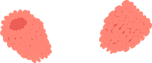 Raspberry