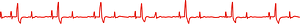 Heart rate line
