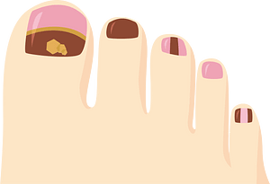 Nail Pedicure