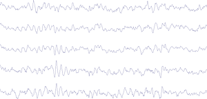 EEG Activity